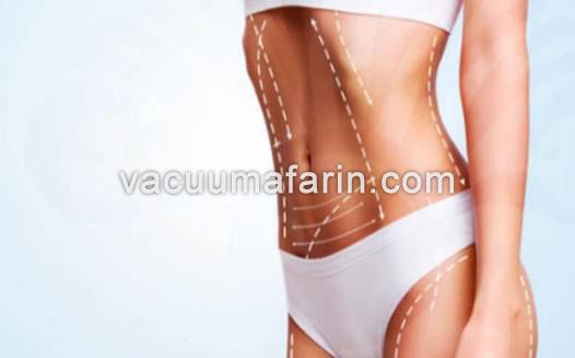 پمپ مخصوص لیپوساکشن برای لاغری پمپ مخصوص لیپوساکشن برای لاغری